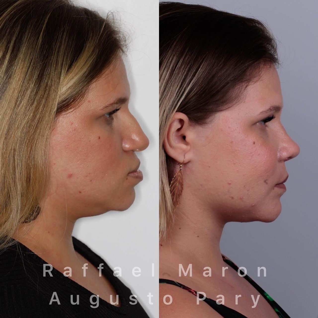 Raffael Maron Vieira De Noronha-22