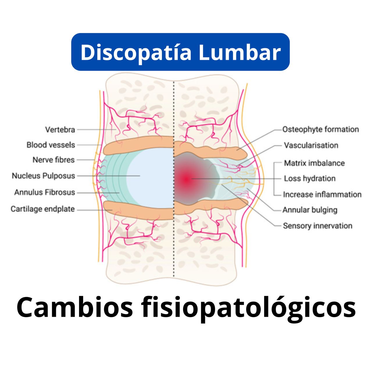 David Tafur Muñoz-2274