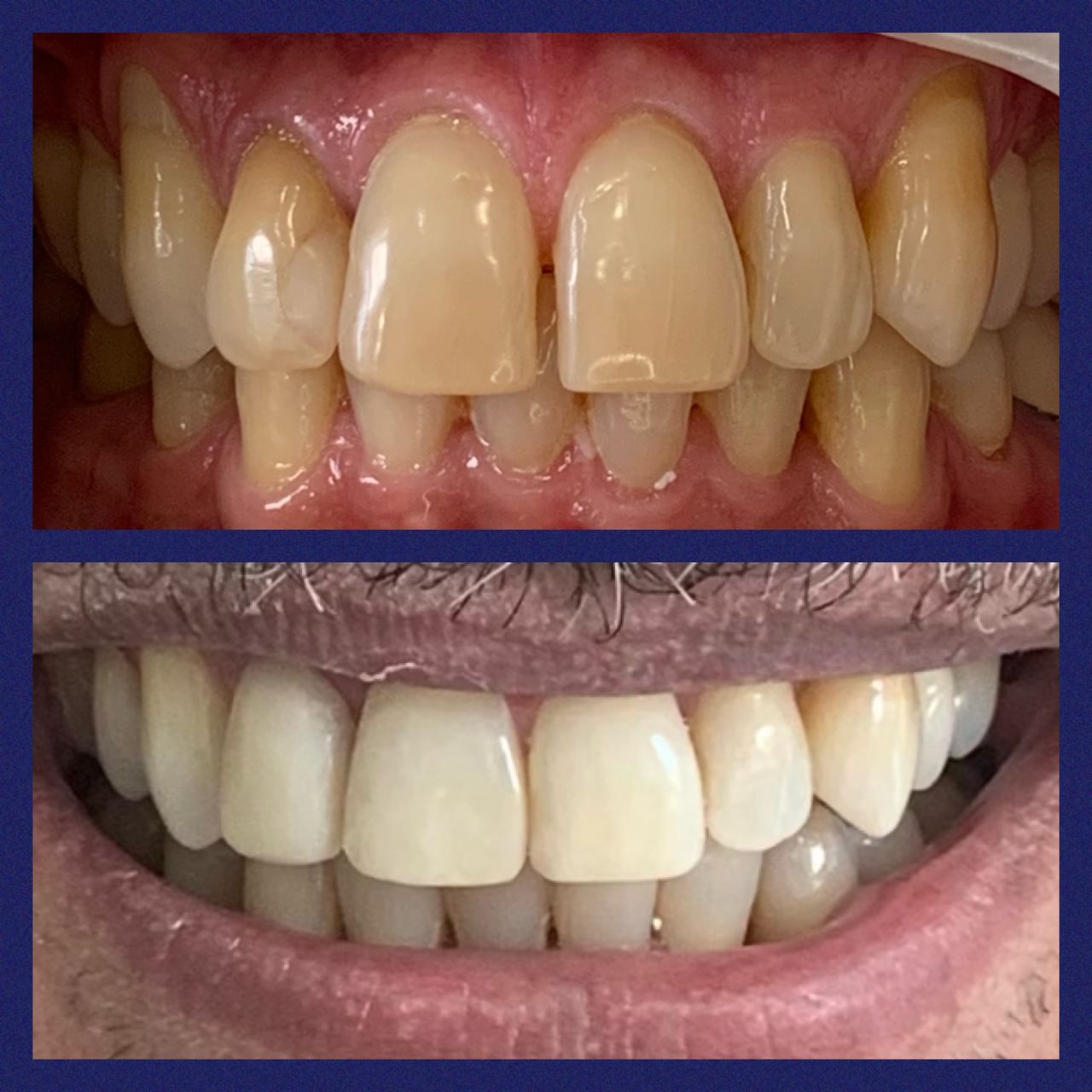 Adriana Souto Nôga .-23