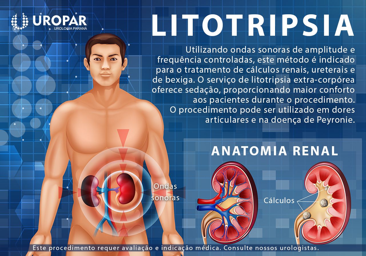 Angelo Palma Contar-7