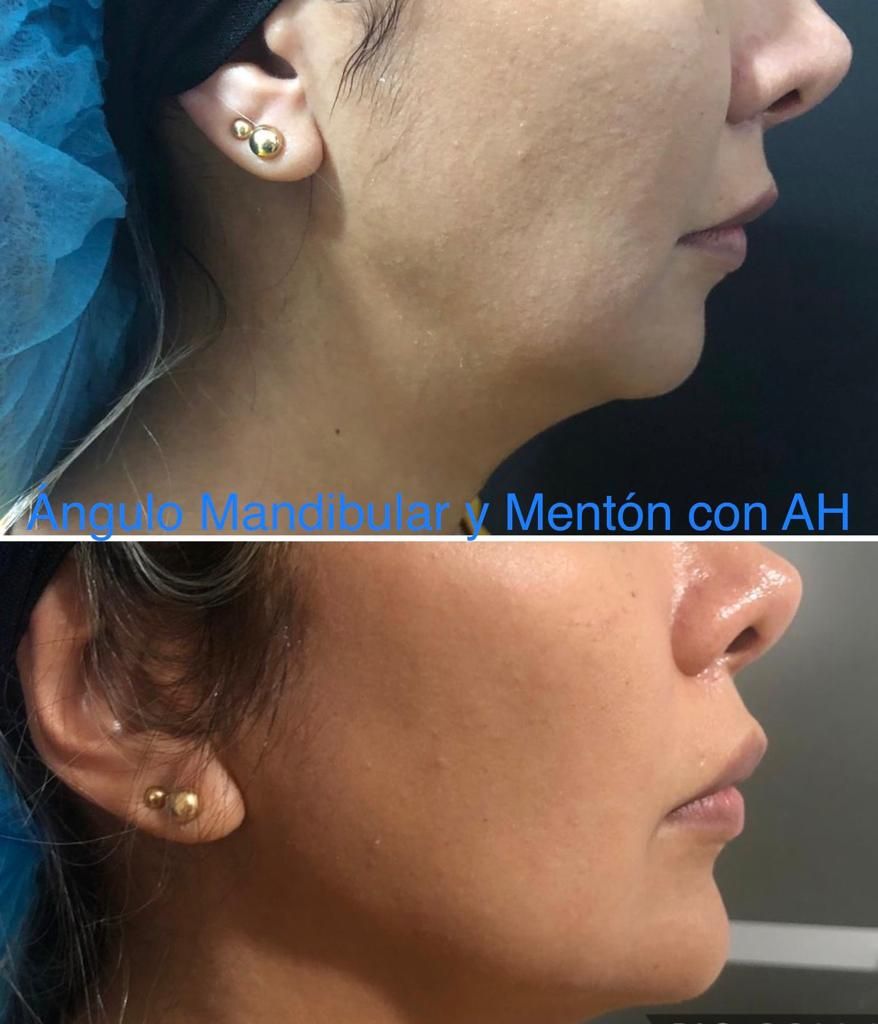 Maria Gisela Angel Losada-45