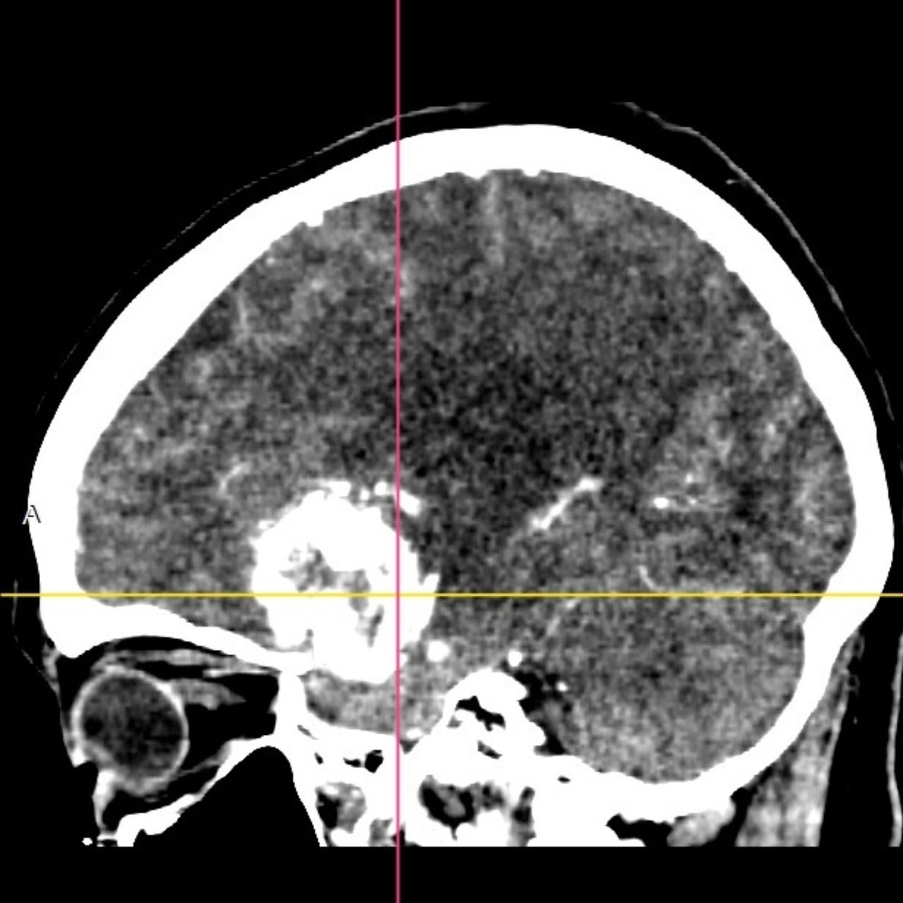 David Tafur Muñoz-1444