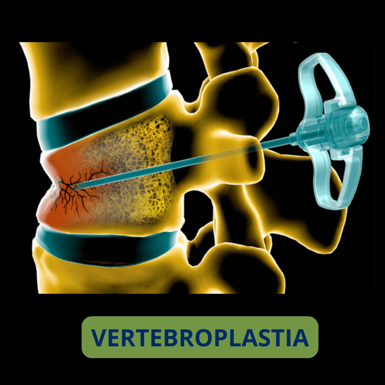 David Tafur Muñoz-1786