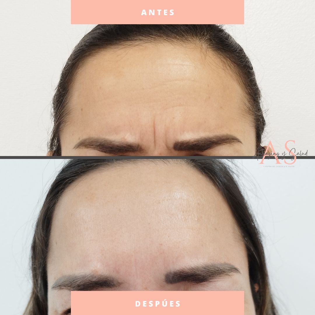 Kattia Peréz Vaca-4