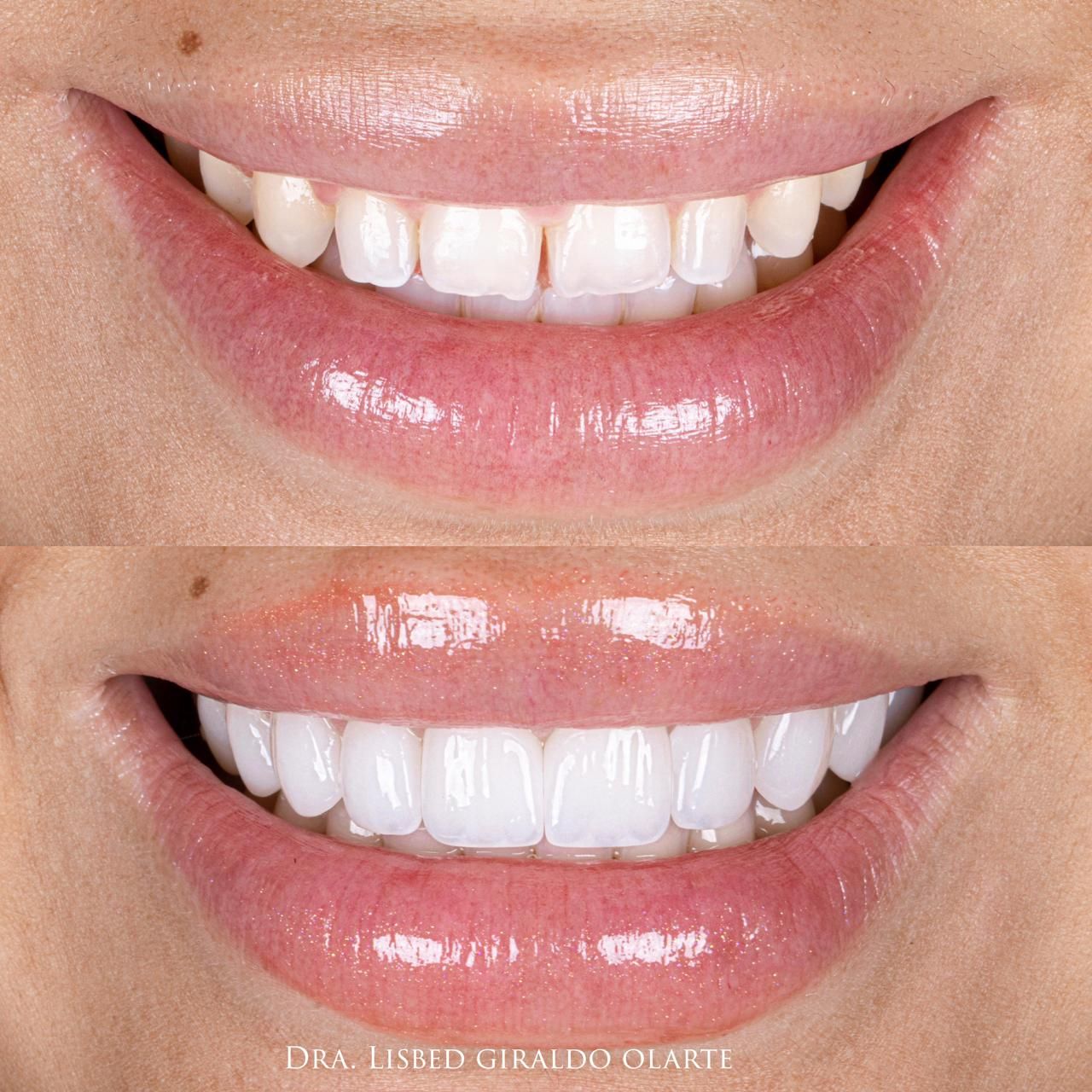 Lisbed Giraldo Olarte-3