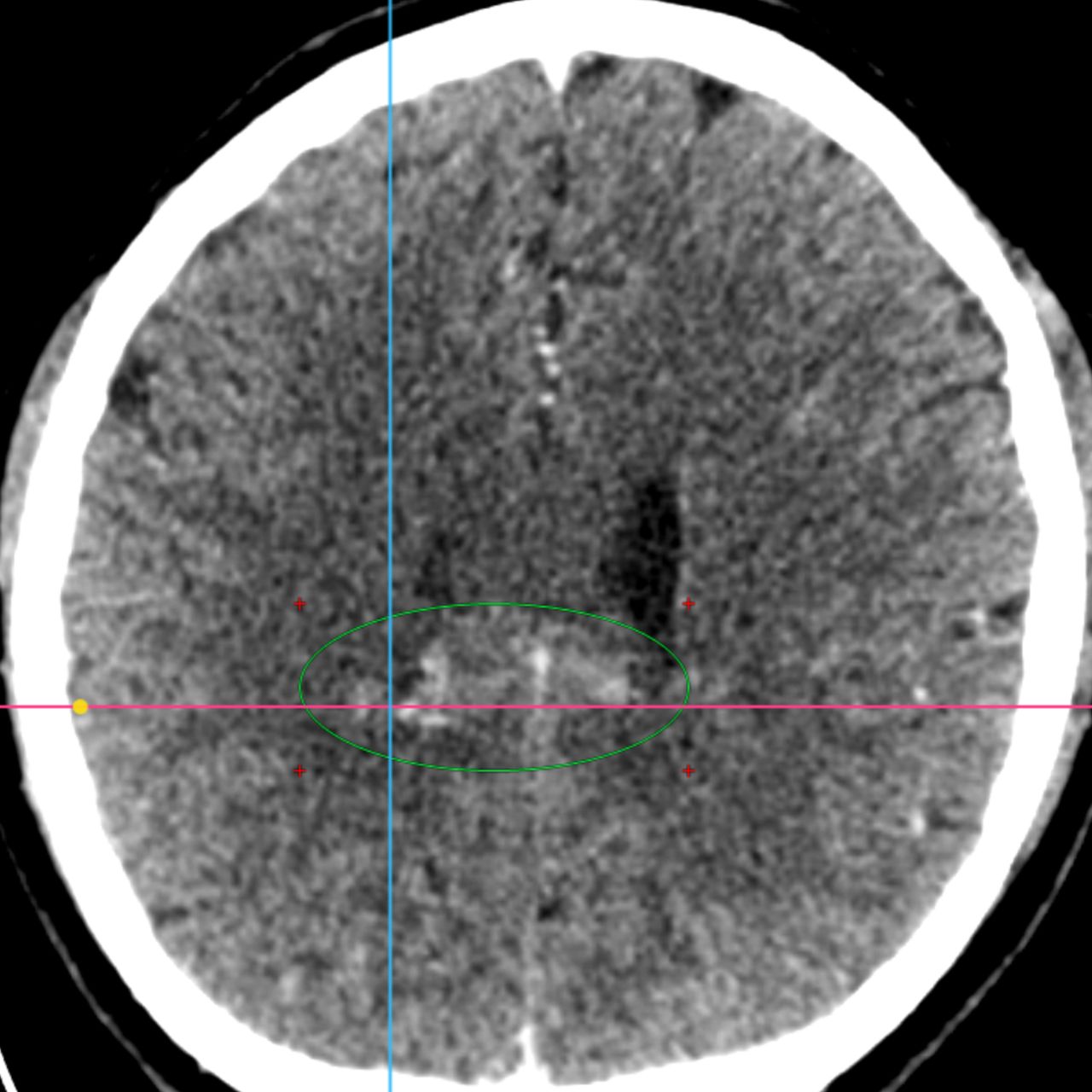 David Tafur Muñoz-1471