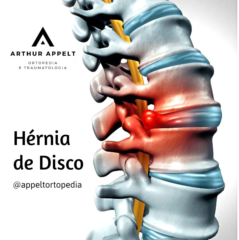 Arthur Lanna Appelt-12