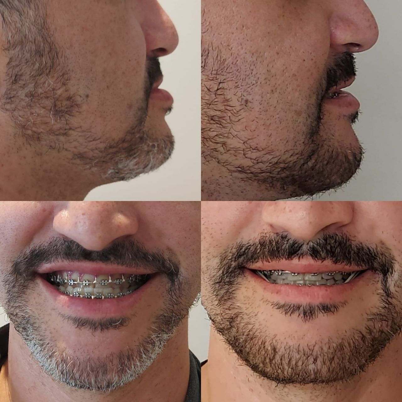 Camila De Loyola E Silva Avellar Fonseca-17