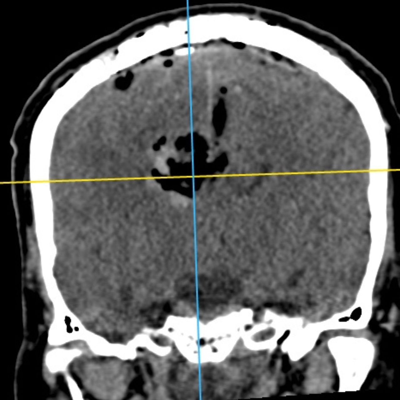 David Tafur Muñoz-1457