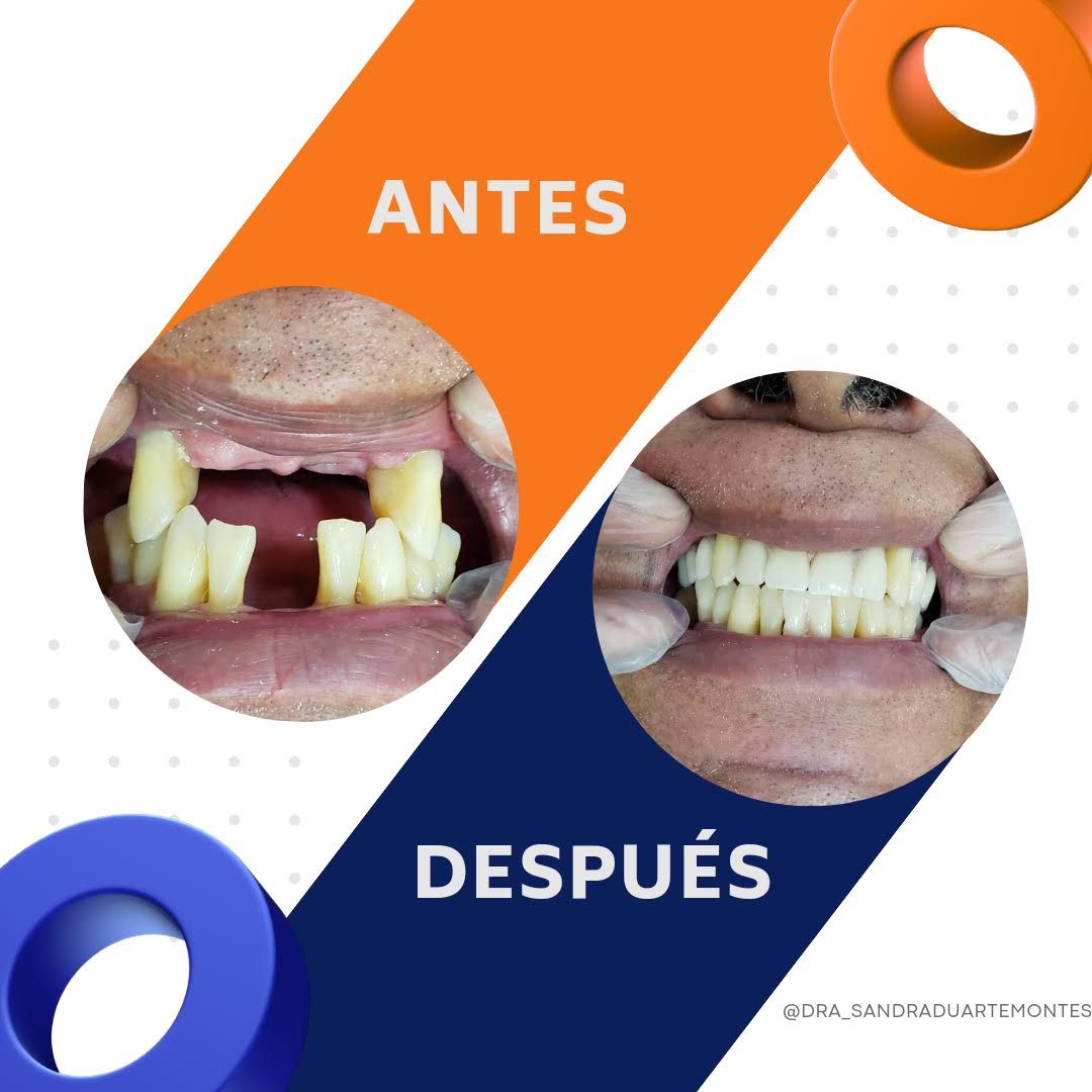 Sandra Duarte Montes-11