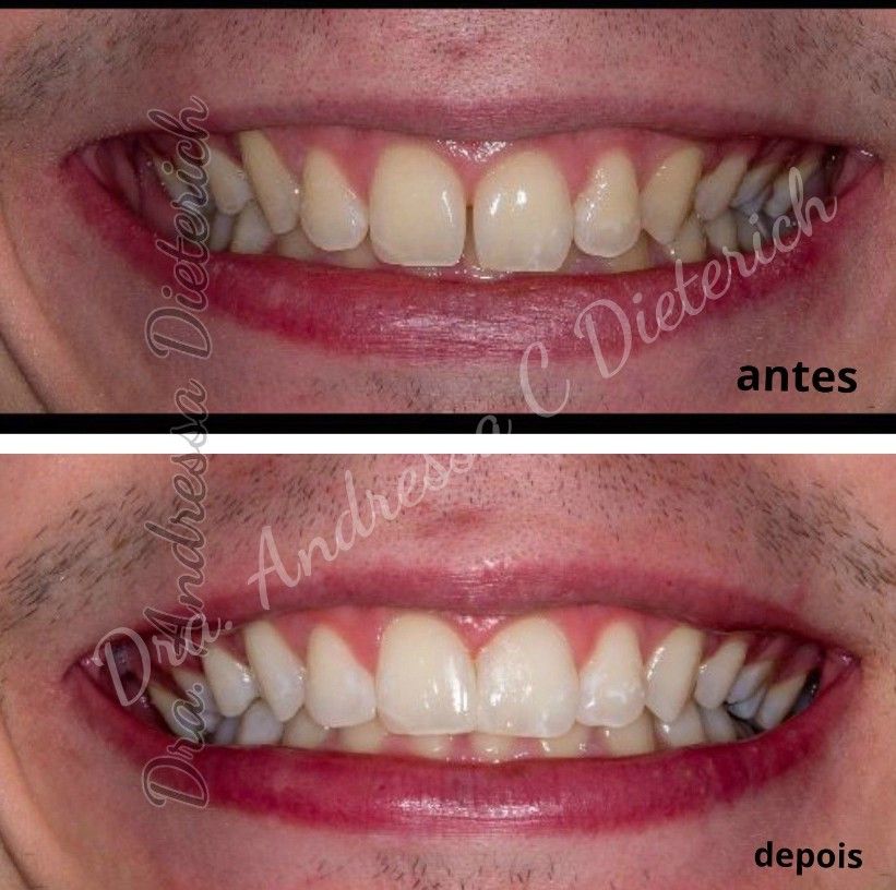 Andressa Dieterich-1