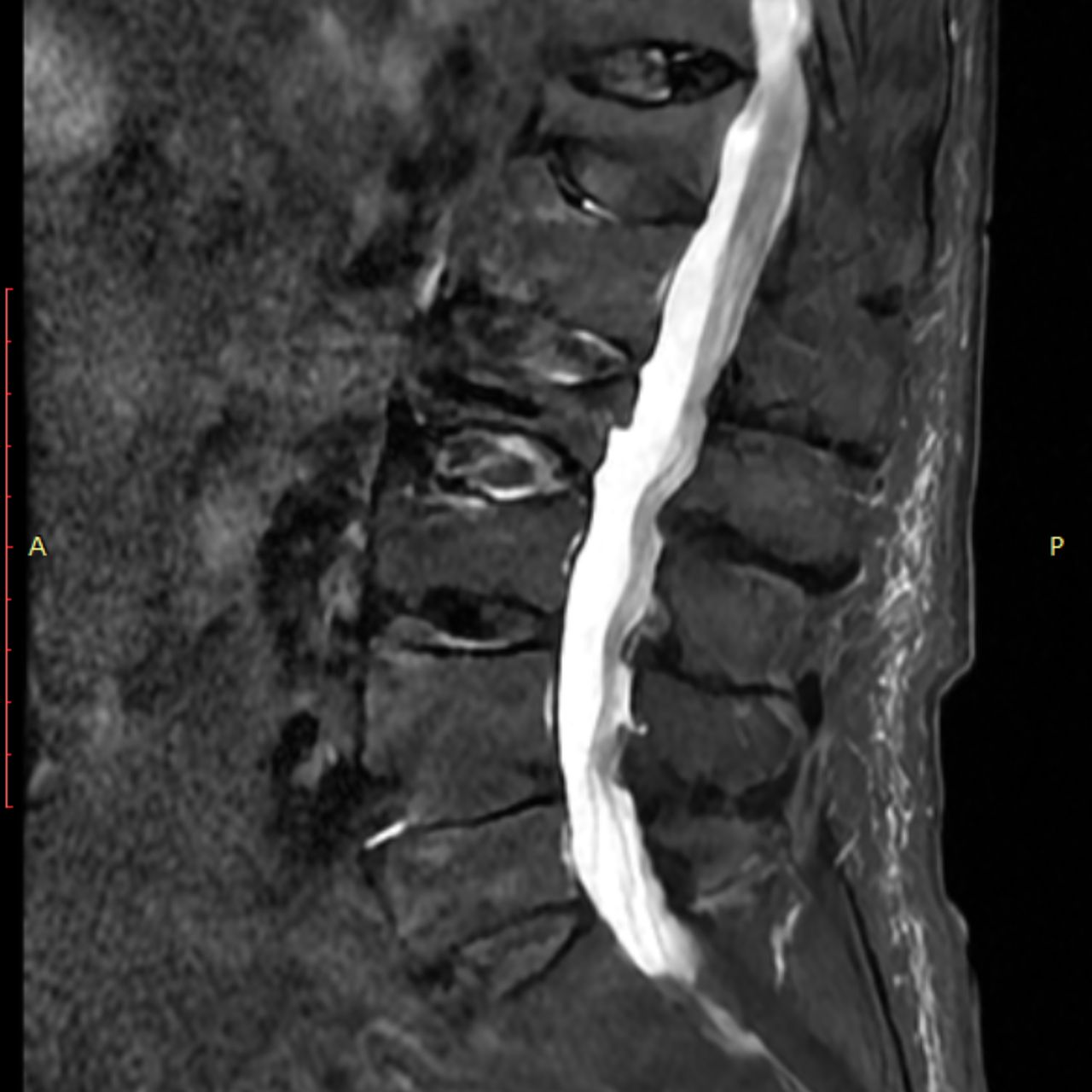 David Tafur Muñoz-1542