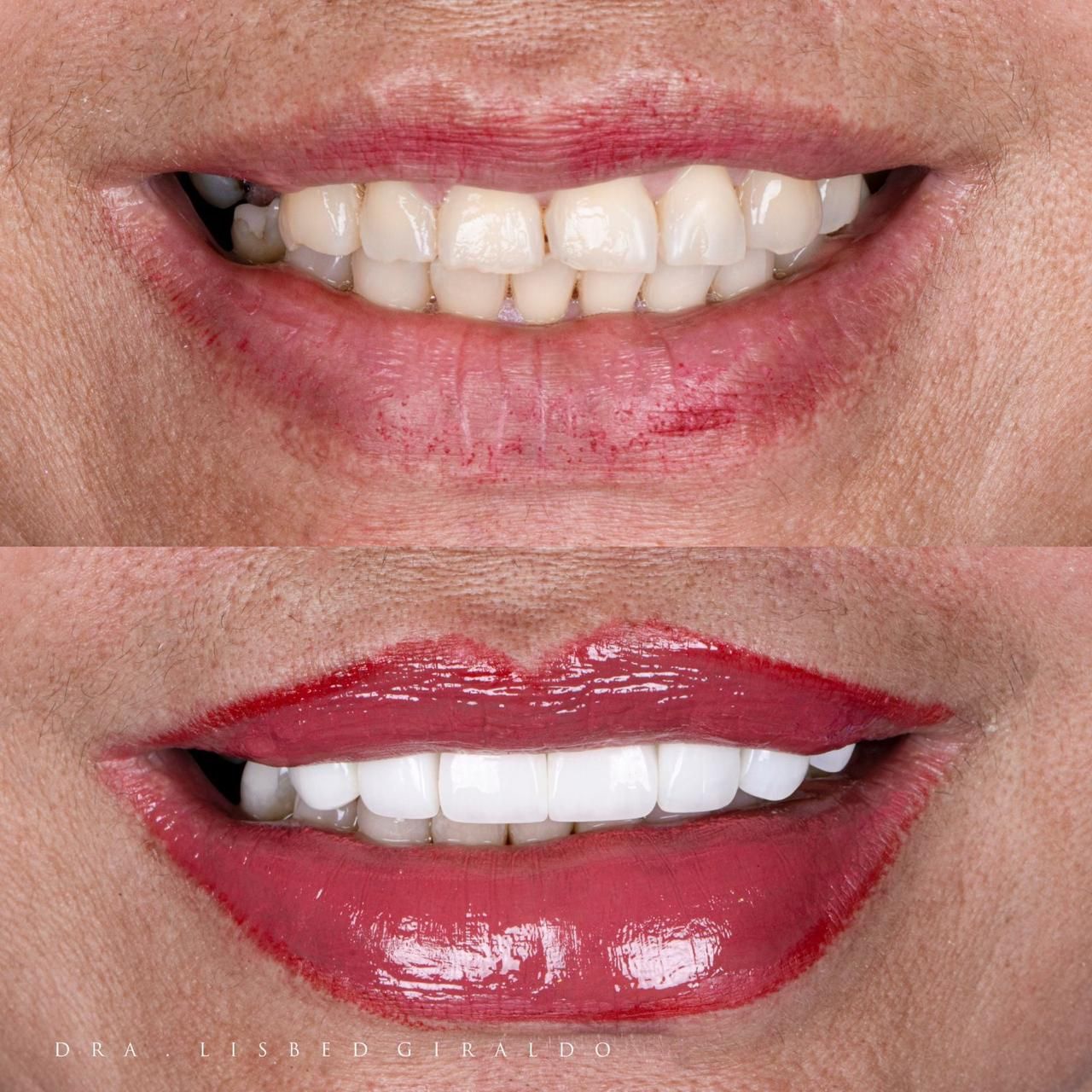 Lisbed Giraldo Olarte-39