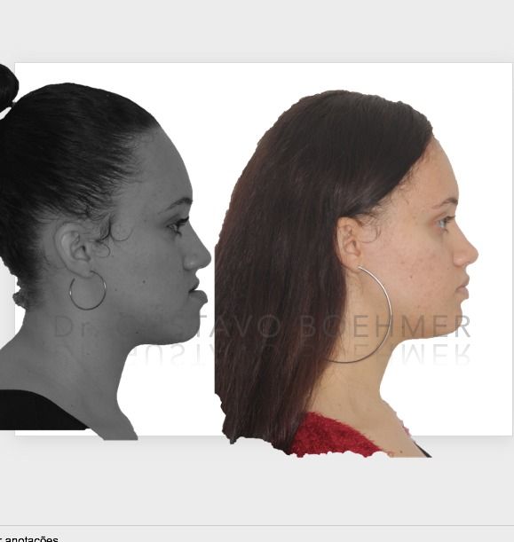 Gustavo Boehmer Leite-6