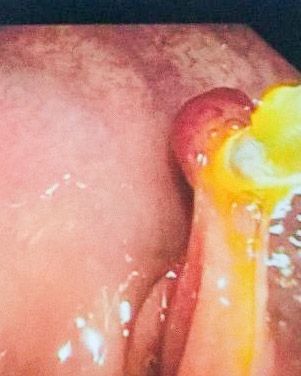 Paulo De Azeredo Passos Candelaria-1