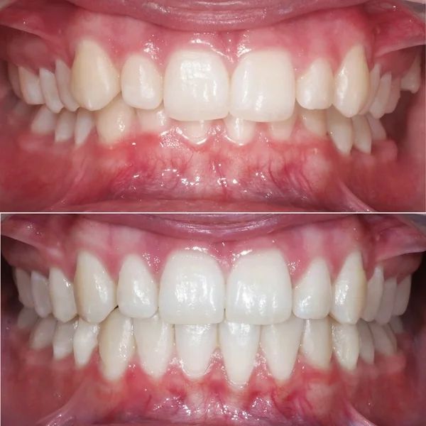 Frank Mendoza Alanya-25