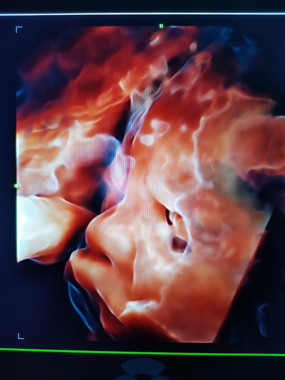 Marcelo Fierro Jarrin-14