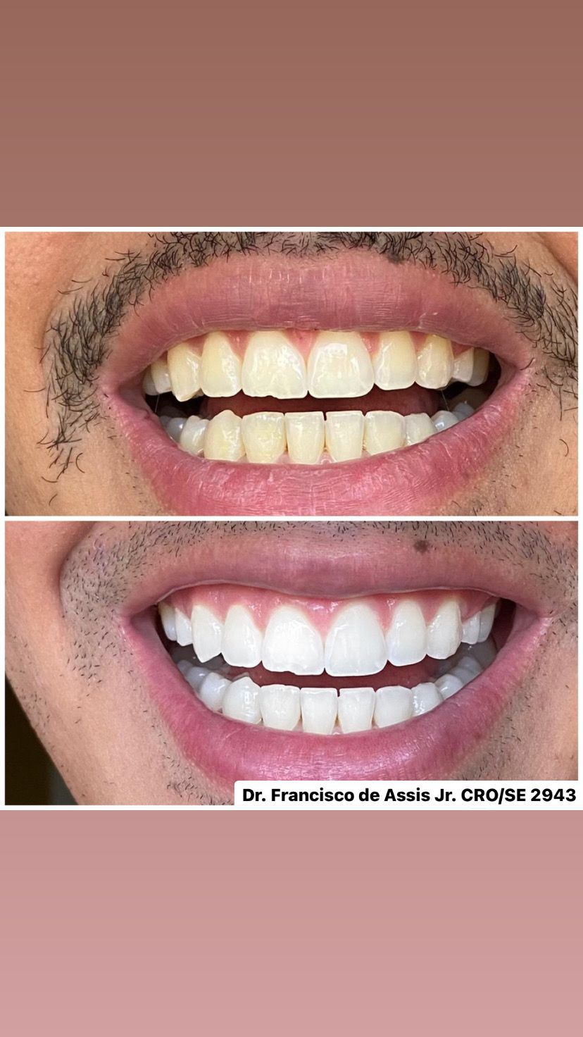 Francisco De Assis Almeida Lima Júnior-13