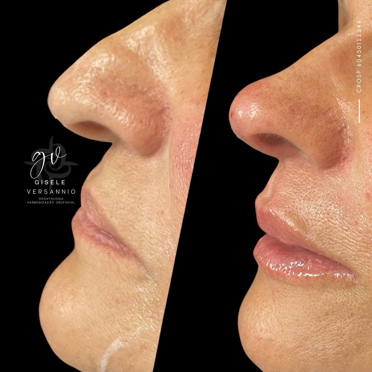 Gisele De Carvalho Versannio-28