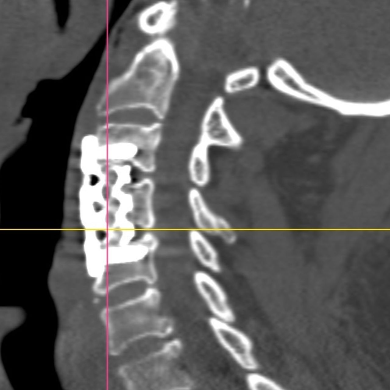 David Tafur Muñoz-1756