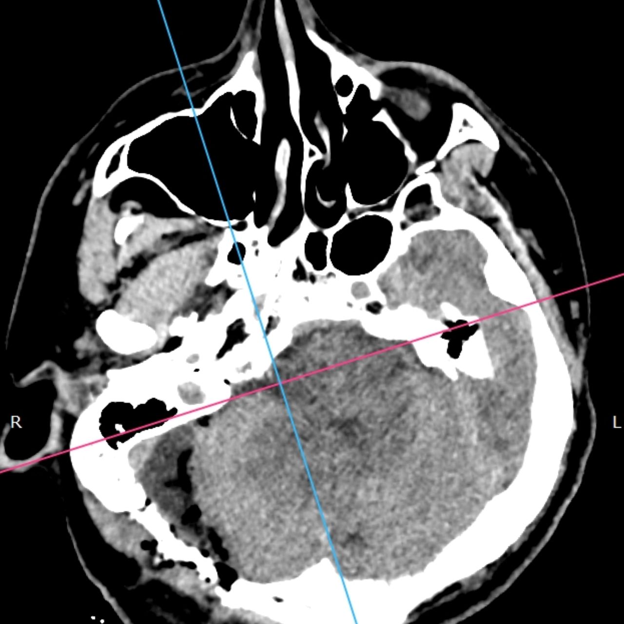 David Tafur Muñoz-1554