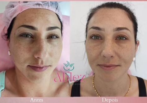 Ana Paula Andreolla-5