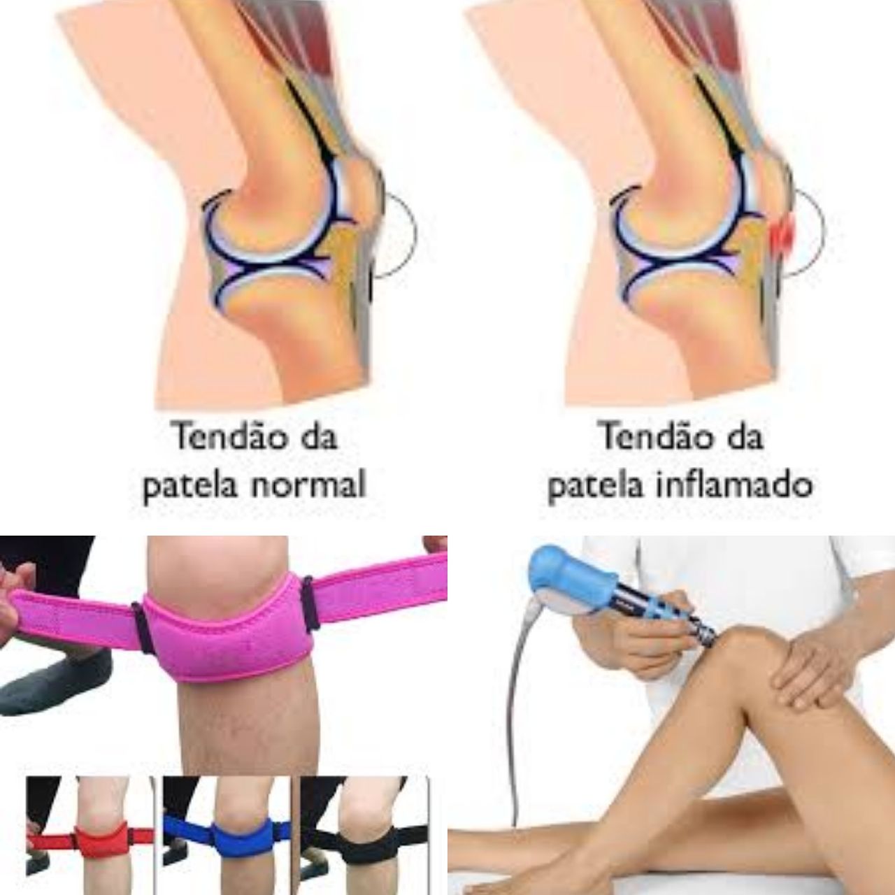 Victor Fontes Pacheco-43