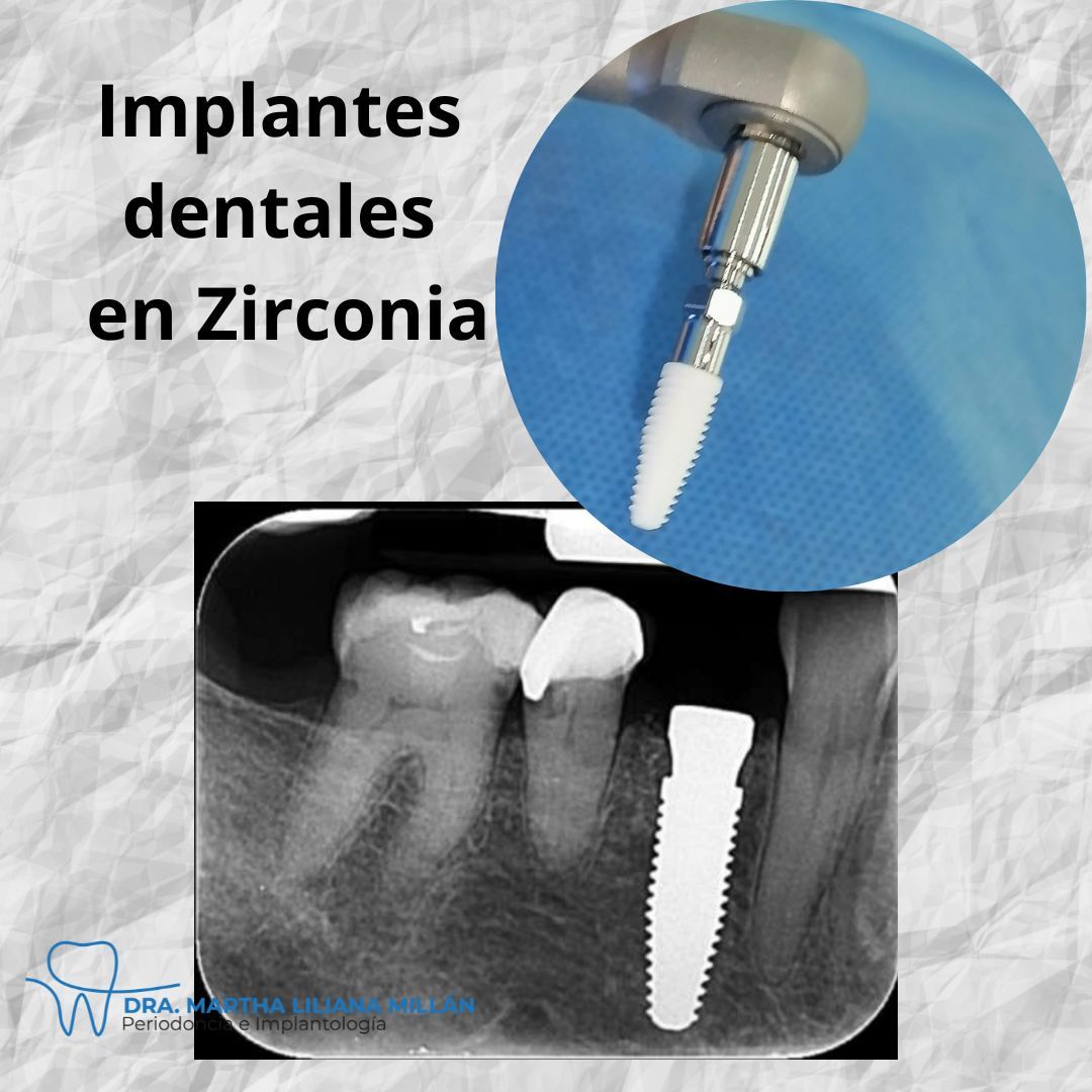 Martha Liliana Millan Diaz-44