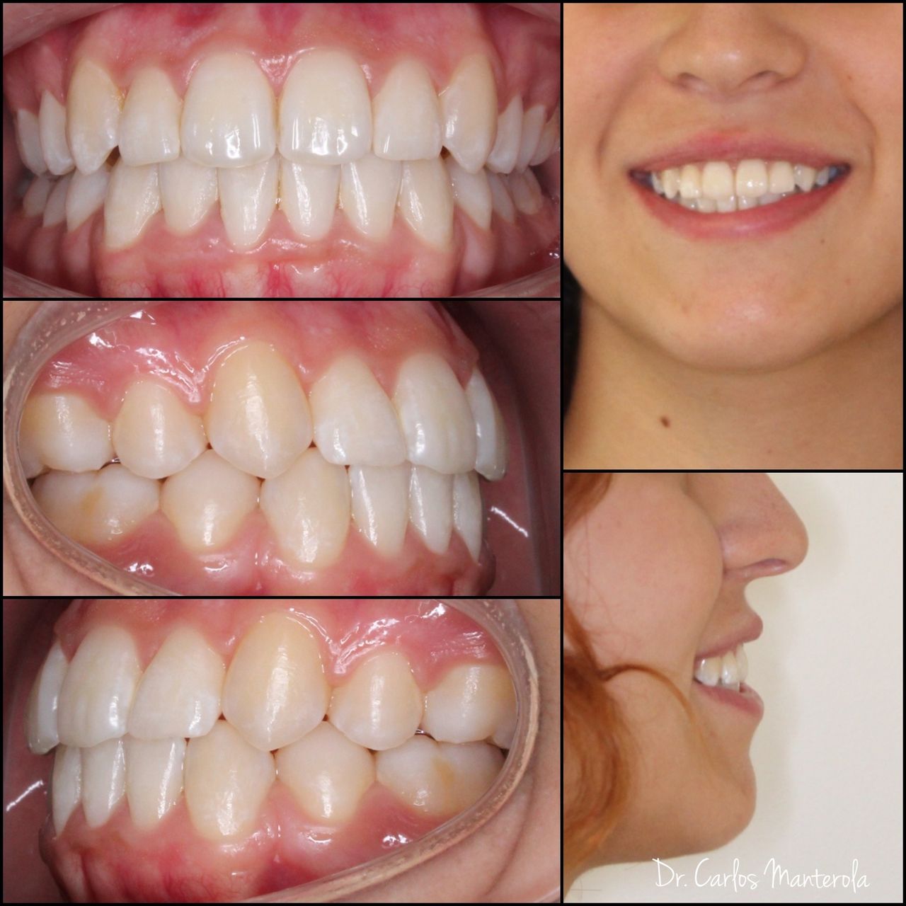 Carlos Manterola Marchant-11