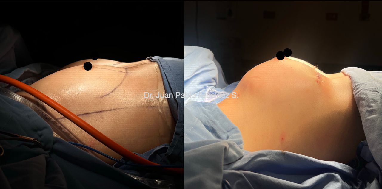 Juan Pablo Arbeláez Sierra-46