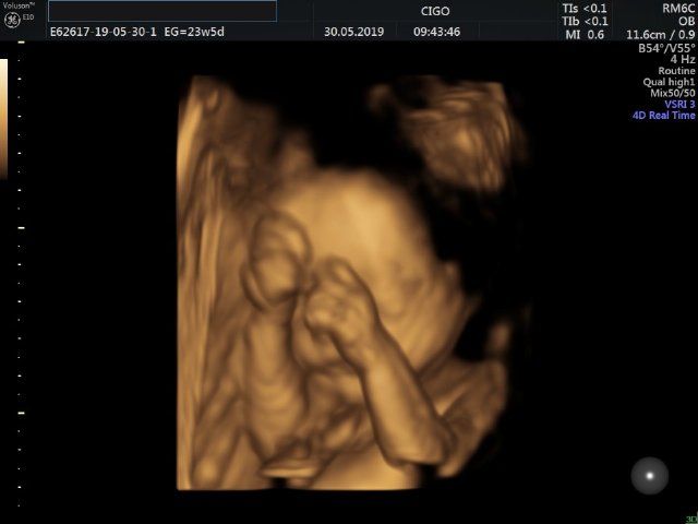 Raul Javier Banderas Pumarino-23