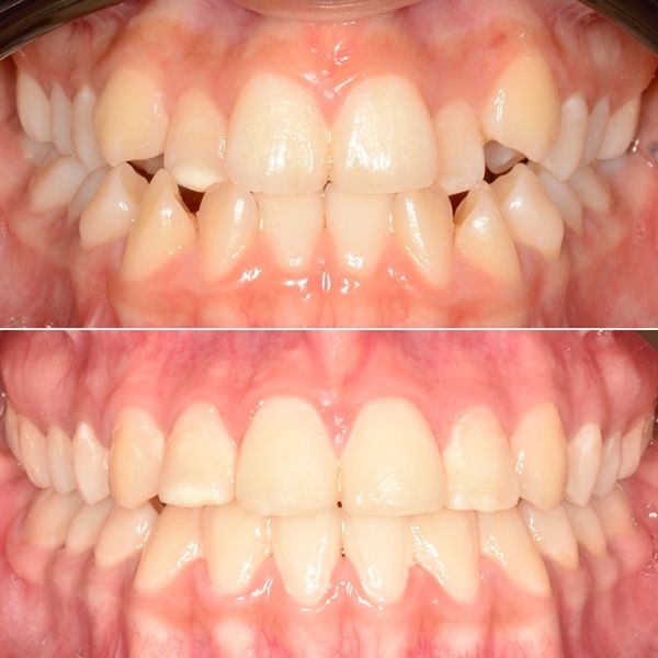 Frank Mendoza Alanya-21