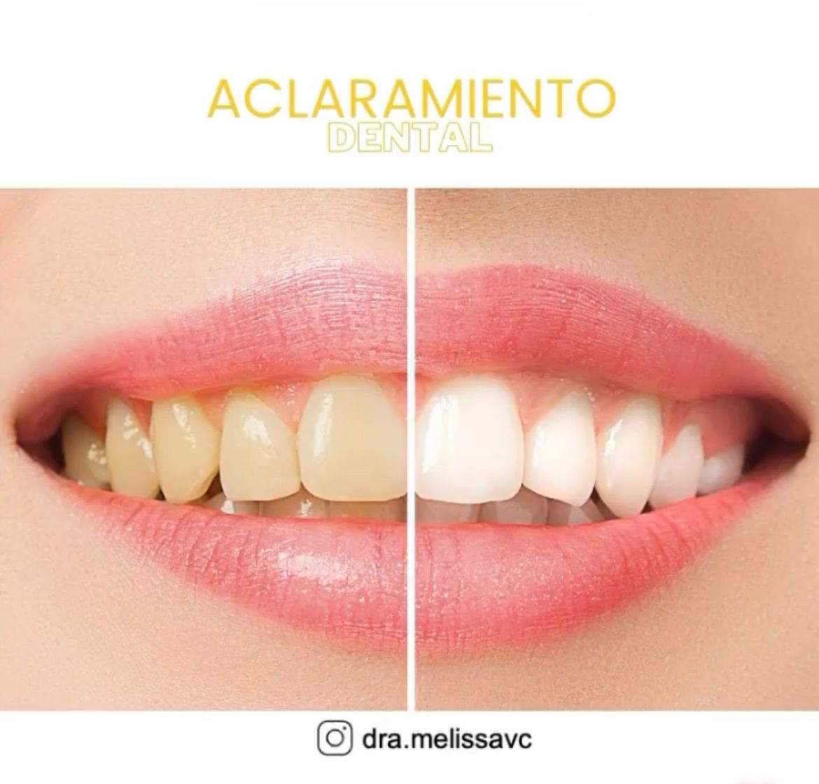 Melissa Vargas Castellanos-19