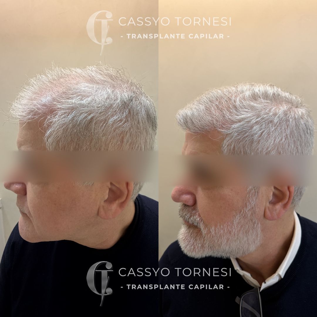 Cassyo Tornesi-26