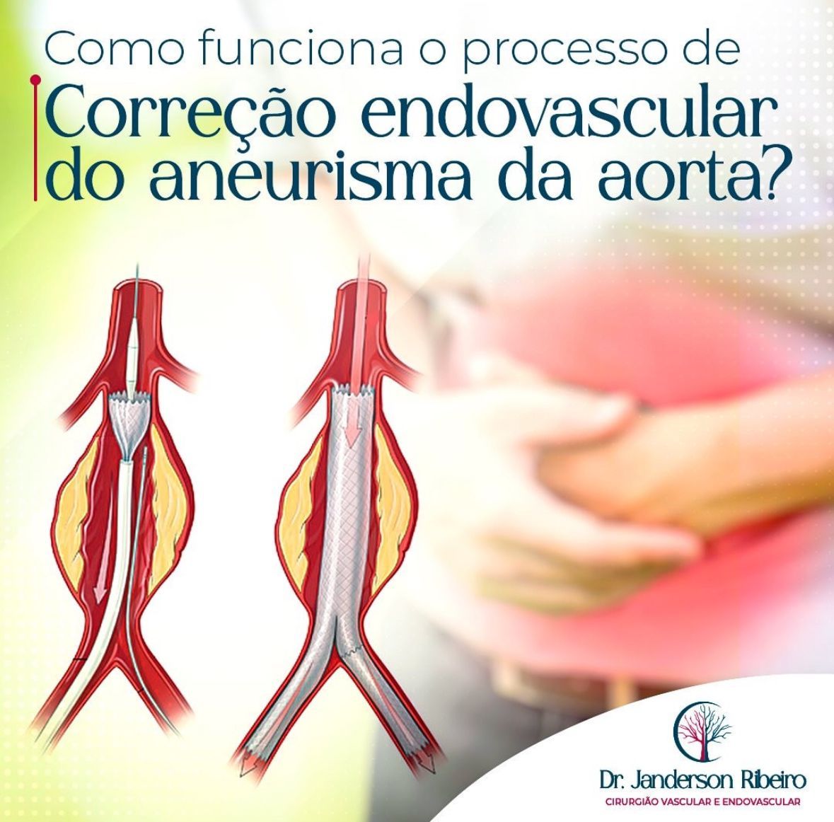 Janderson Ribeiro Fernandes-20