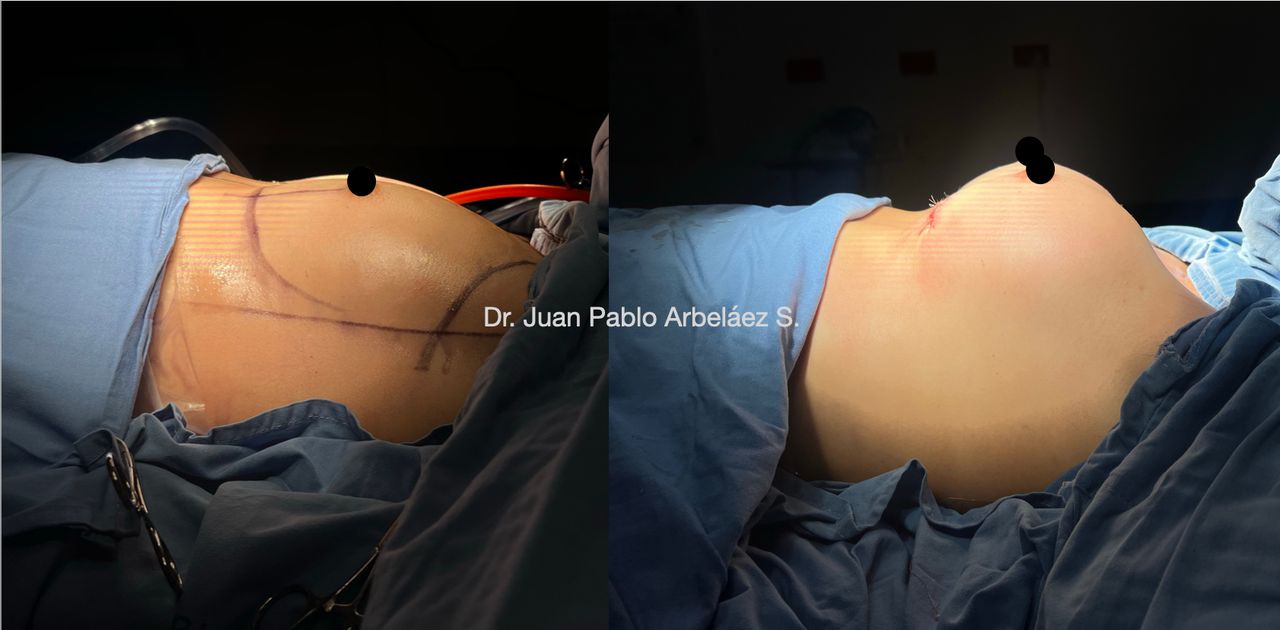 Juan Pablo Arbeláez Sierra-45