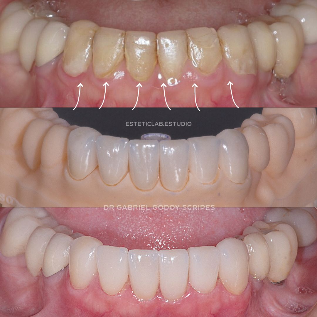 Gabriel Godoy Scripes-6