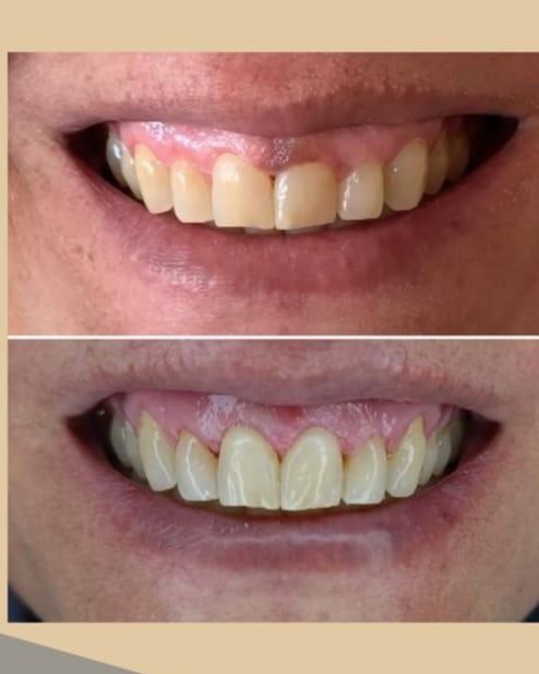 Camila De Loyola E Silva Avellar Fonseca-3