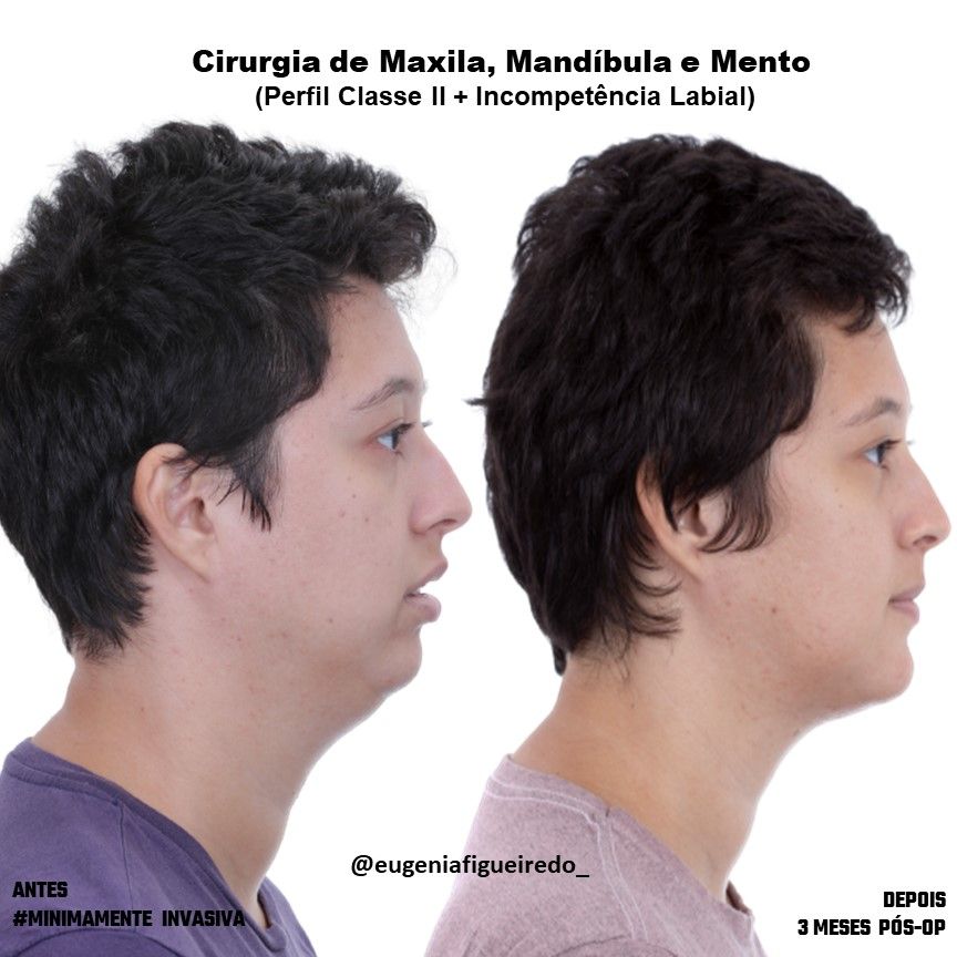 Eugênia Figueiredo-21