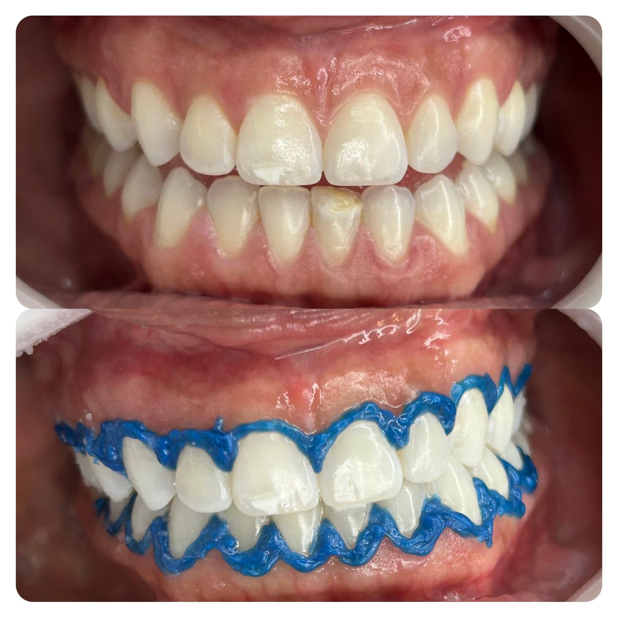 Ana Clara Almeida-10