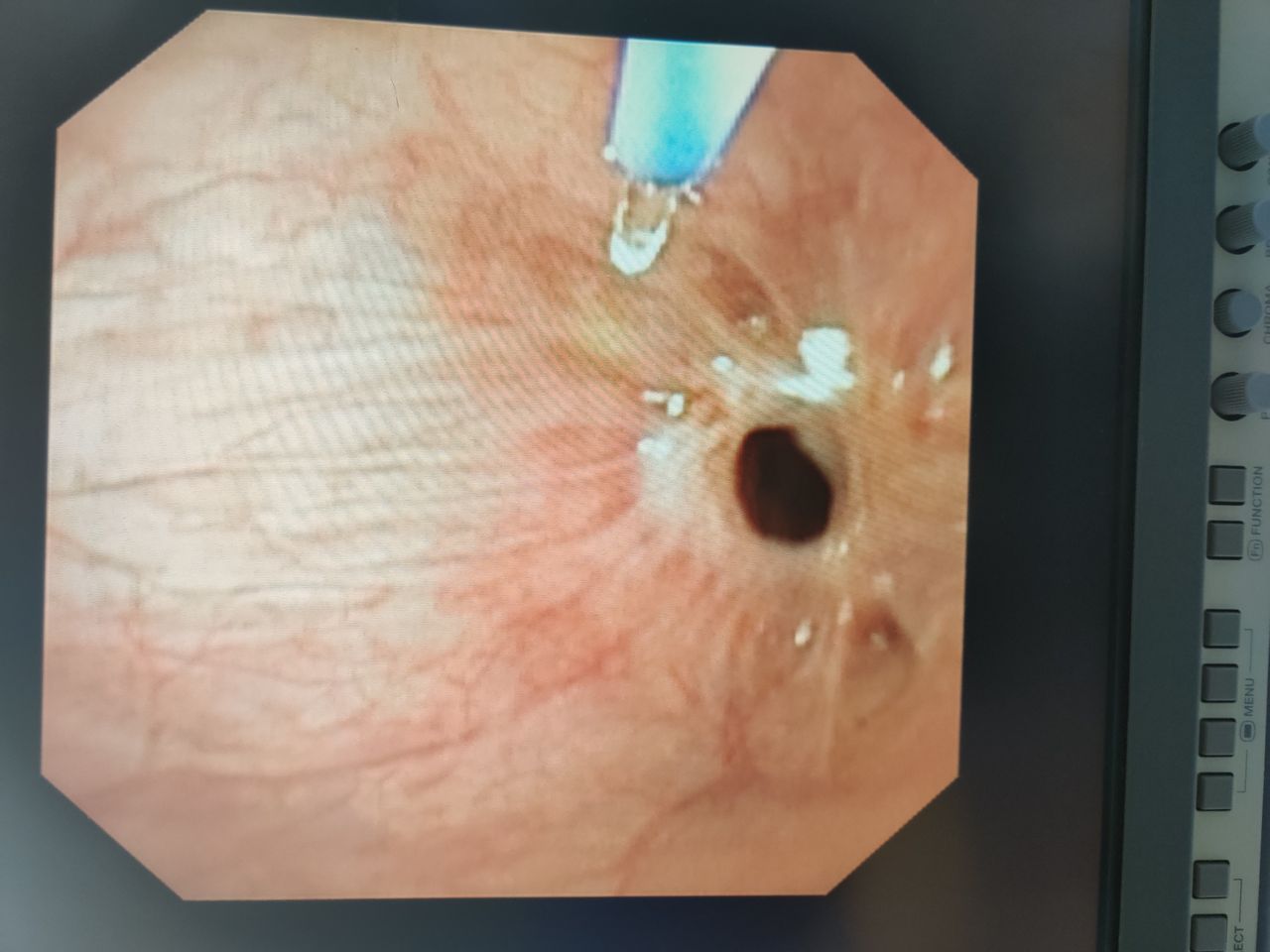 Willfredy Castaño Ruiz-15