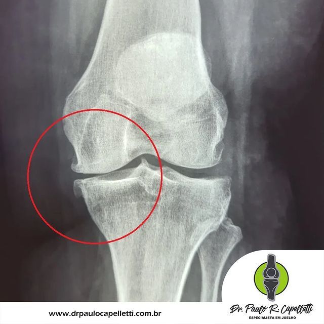 Paulo Roberto Capelletti-28