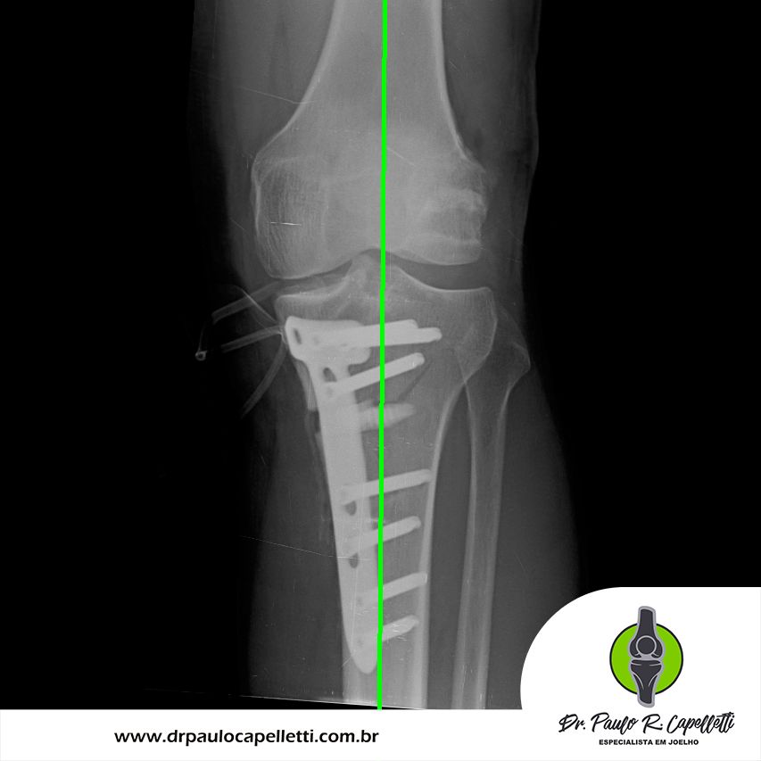 Paulo Roberto Capelletti-5