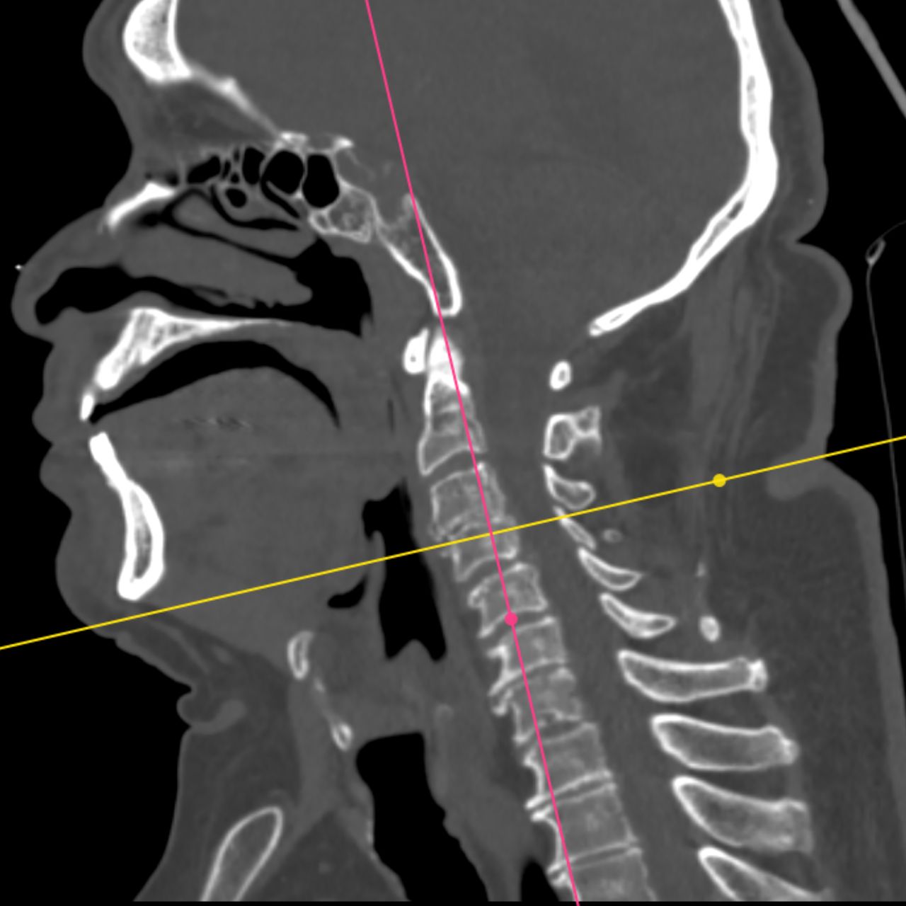 David Tafur Muñoz-1826