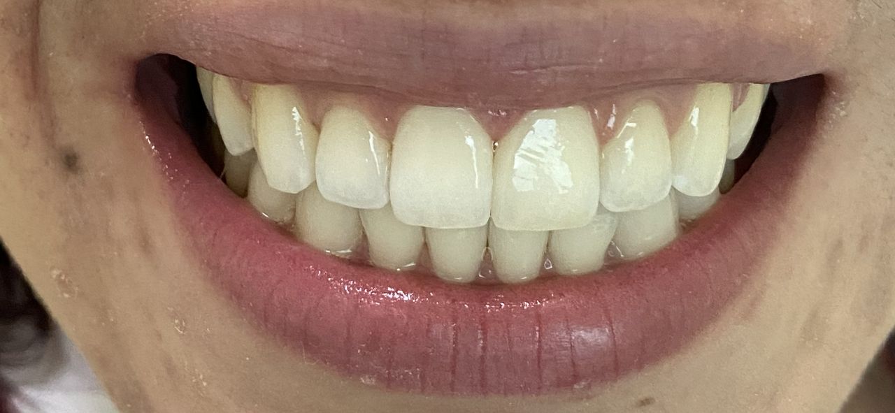 Antônio Alegria Do Nascimento-11