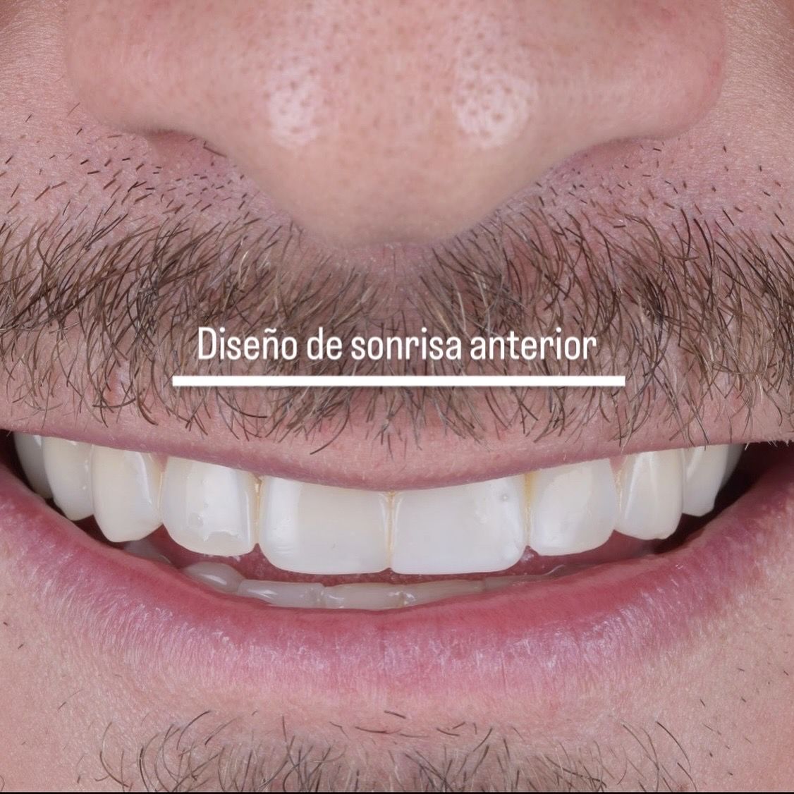 Maria Camila Patiño Zuluaga-3