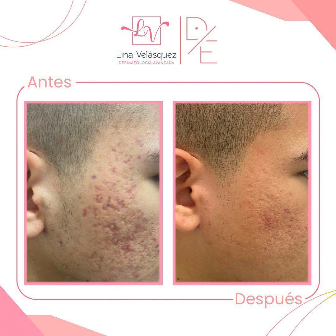 Lina Velásquez Tafur-11