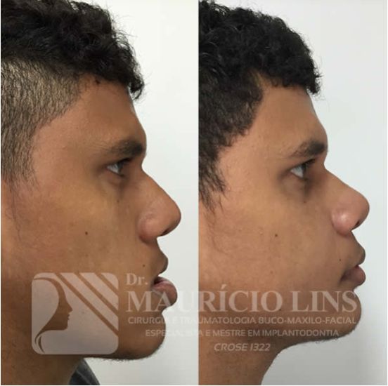 Mauricio Lins Moura-16