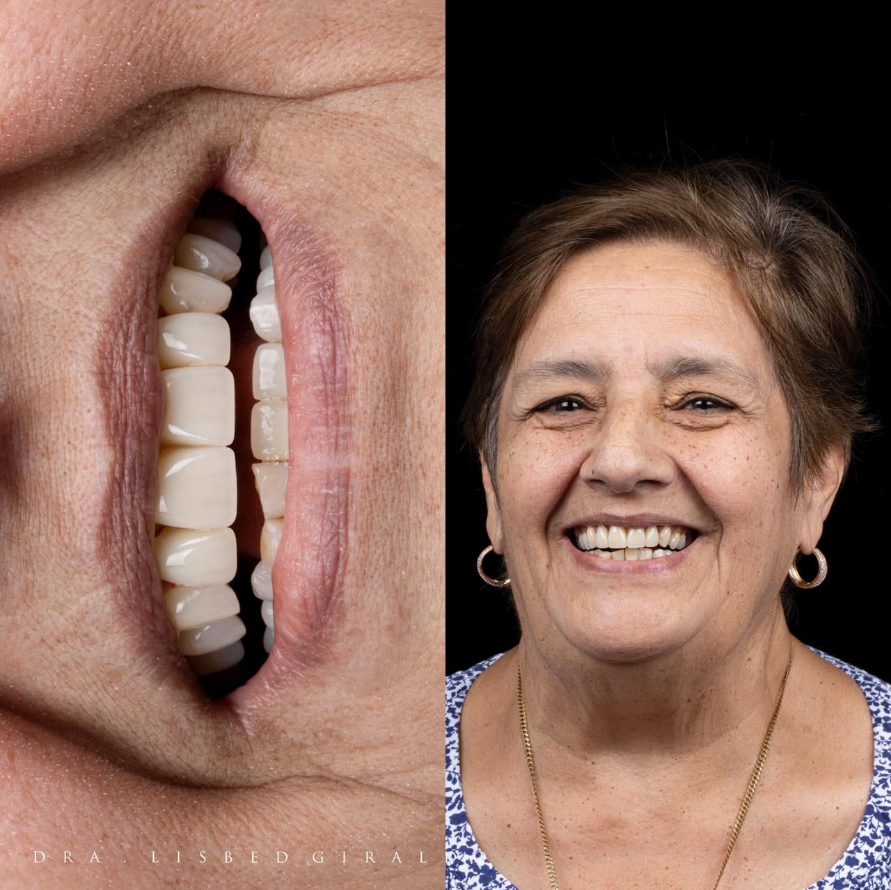 Lisbed Giraldo Olarte-35