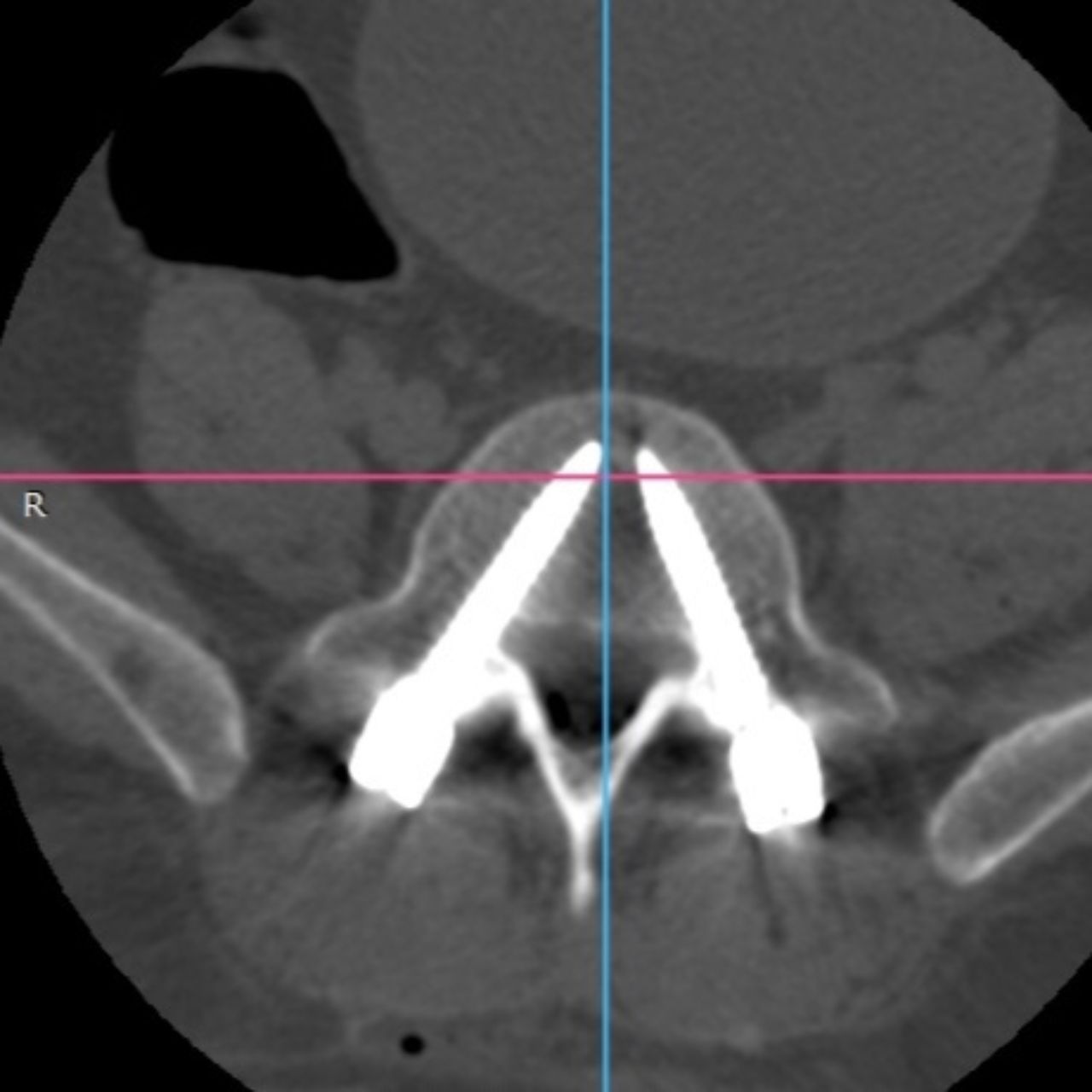 David Tafur Muñoz-1738